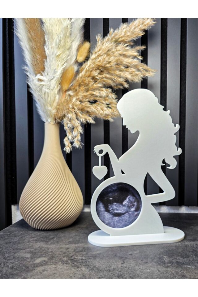 Ultrason Fotoğraf Çerçevesi – Yenidoğan Hatırası