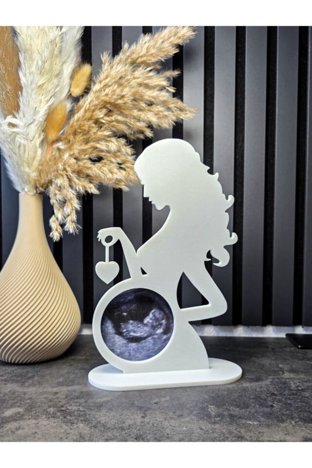 Ultrason Fotoğraf Çerçevesi – Yenidoğan Hatırası